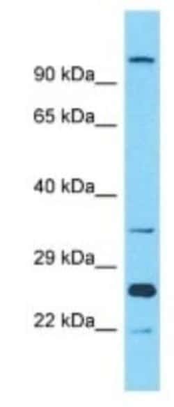 OR10A2 Rabbit anti-Human, Polyclonal, Novus Biologicals 100 &mu;g; Unconjugated:Antibodies,